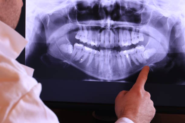 Best Pediatric Emergency Dentist in Russiaville, IN