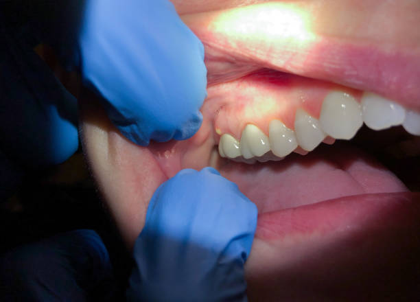 Best 24-Hour Emergency Dentist in Russiaville, IN