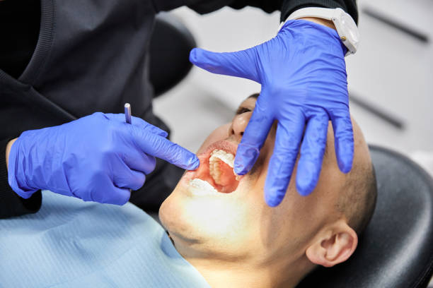 Best Emergency Denture Repair in Russiaville, IN